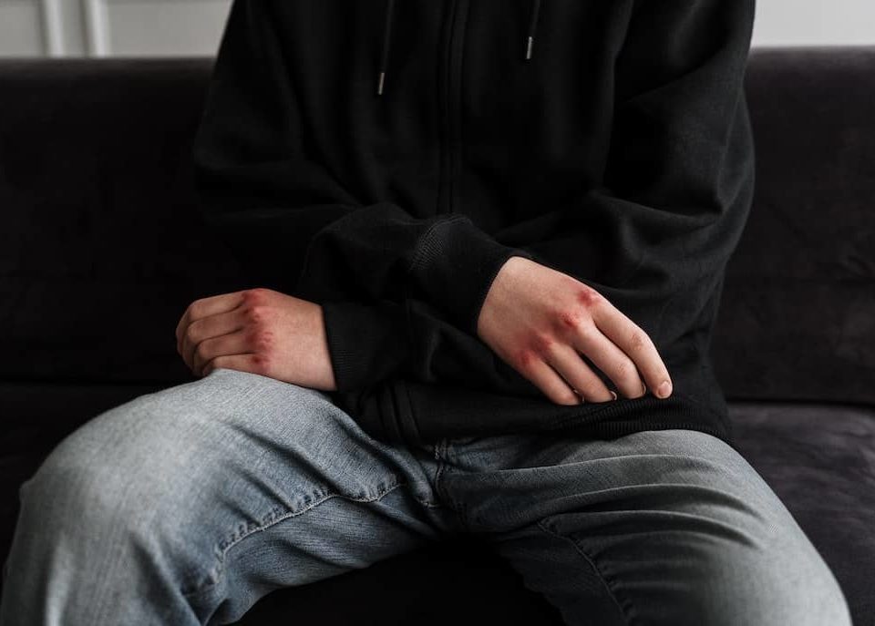 Comment aider un adolescent qui pratique l'automutilation ?